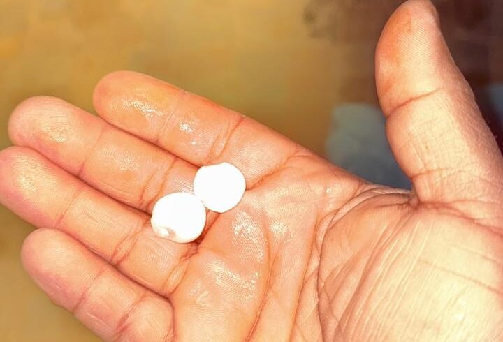 Tromba y granizo sorprende a La Laguna; reportan daños